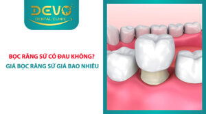 boc rang su co dau khong