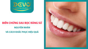 bien chung sau boc rang su