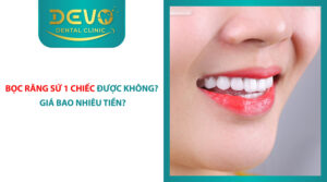 boc rang su bao nhiu 1 chiec