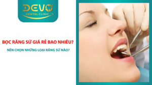 Boc rang su gia re bao nhieu