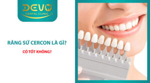 Răng sứ Cercon là gì? có tốt không