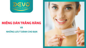 Những lưu ý khi dán miếng trắng răng