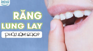 rang-lung-lay