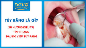 xu huong dieu tri tinh trang dau do viem tuy rang
