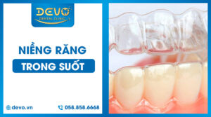 nieng-rang-trong-suot-gia-bao-nhieu