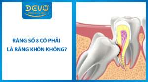 rang so 8 co phai la rang khon khong