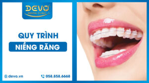 Quy-trinh-nieng-rang