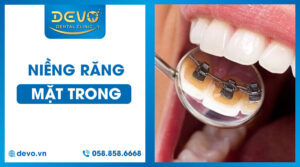 nieng-rang-mat-trong