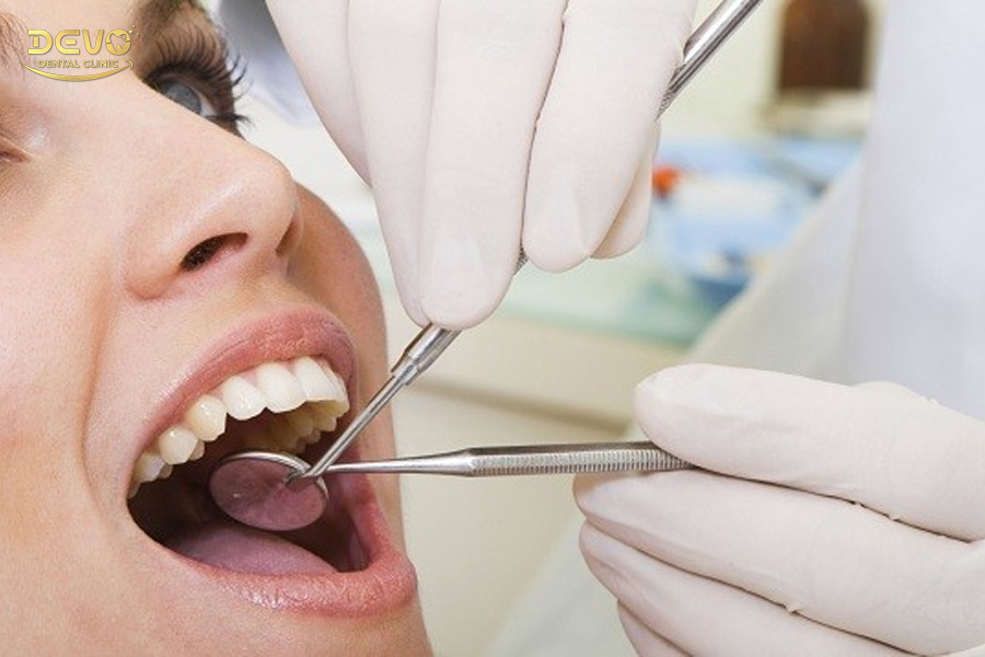Phương pháp giảm sâu răng